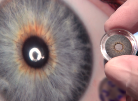 人类光学公司人工虹膜获得FDA批准