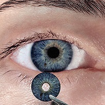 Good news / Artificial iris is coming soon